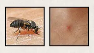 blackfly-bite