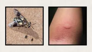 deer-fly-bite-welt