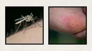 mosquito-bite