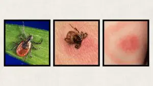 tick-deer-tick-bite